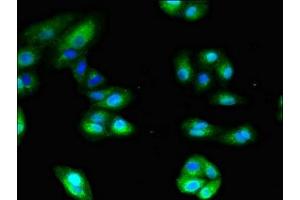 Immunofluorescent analysis of HepG2 cells using ABIN7144005 at dilution of 1:100 and Alexa Fluor 488-congugated AffiniPure Goat Anti-Rabbit IgG(H+L)