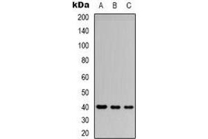 Western blot analysis of CD32b expression in Jurkat (A), SHSY5Y (B), HEK293T (C) whole cell lysates. (FCGR2B anticorps  (C-Term))