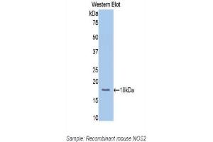 Detection of Recombinant NOS2, Mouse using Polyclonal Antibody to Nitric Oxide Synthase 2, Inducible (NOS2)