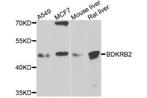 Western blot analysis of extracts of various cell lines, using BDKRB2 antibody. (BDKRB2 anticorps  (AA 302-391))