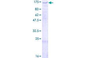 Image no. 1 for Nuclear Autoantigenic Sperm Protein (Histone-Binding) (NASP) (AA 1-790) protein (GST tag) (ABIN7540250)