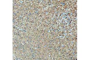 IHC analysis of ABI2 using anti-ABI2 antibody (ABIN7600125).