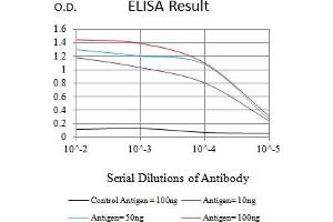 Black line: Control Antigen (100 ng),Purple line: Antigen (10 ng), Blue line: Antigen (50 ng), Red line:Antigen (100 ng)
