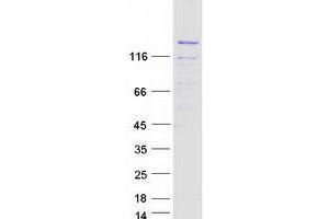 Validation with Western Blot