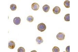 Immunocytochemistry of DFF45 in HeLa cells with AP30289PU-N DFF45 antibody at 5 μg/ml.