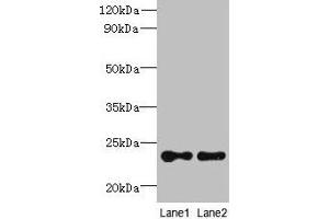 Western blot All lanes: TMED2 antibody at 6 μg/mL Lane 1: HCT116 whole cell lysate Lane 2: Mouse ovarian tissue Secondary Goat polyclonal to rabbit IgG at 1/10000 dilution Predicted band size: 23 kDa Observed band size: 23 kDa (TMED2 anticorps  (AA 26-111))