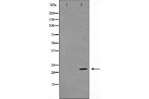 Western blot analysis of BAD expression in Forskolin treated 293 whole cell lysates,The lane on the left is treated with the antigen-specific peptide. (BAD anticorps  (Internal Region))