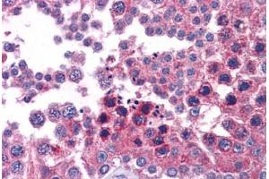 Human Testis: Formalin-Fixed, Paraffin-Embedded (FFPE)