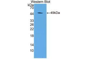 Western blot analysis of recombinant Rat a1AGP. (ORM1 anticorps  (AA 19-186))