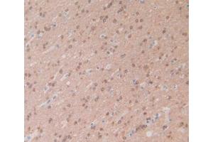 IHC-P analysis of Human Brain Tissue, with DAB staining. (CRYAB anticorps  (AA 1-175))