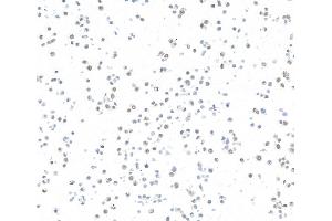 Immunocytochemistry (ICC) image for anti-AT Rich Interactive Domain 1A (SWI-Like) (ARID1A) (AA 750-800) antibody (ABIN7795678)