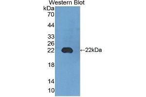 Figure. (EMR2 anticorps  (AA 347-509))