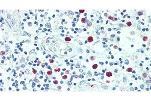 Immunohistochemistry of paraffin-embedded Thymus tissue using SRGN Polyclonal Antibody at dilution of 1:100. (SRGN anticorps)