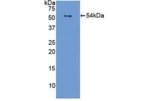 Western blot analysis of recombinant Mouse FLG. (Filaggrin anticorps  (AA 119-336))