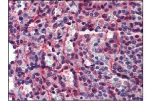 Immunohistochemistry (IHC) image for anti-Caspase 7, Apoptosis-Related Cysteine Peptidase (CASP7) antibody (ABIN614356) (Caspase 7 anticorps)