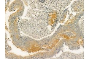 anti-Cubilin (Intrinsic Factor-Cobalamin Receptor) (CUBN) (N-Term) antibody