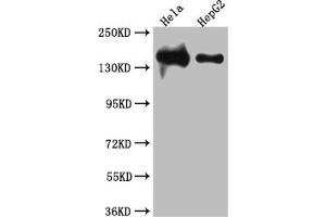 Western Blot Positive WB detected in: Hela whole cell lysate, HepG2 whole cell lysate All lanes: DNA Ligase I antibody at 1:1000 Secondary Goat polyclonal to rabbit IgG at 1/50000 dilution Predicted band size: 102, 89, 99 kDa Observed band size: 140 kDa (Recombinant LIG1 anticorps)
