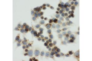 anti-Insulin-Like Growth Factor 2 Receptor (IGF2R) (AA 2475-2491), (C-Term) antibody