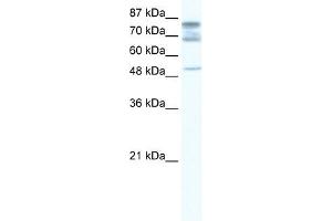 DDX46 antibody used at 1. (DDX46 anticorps)