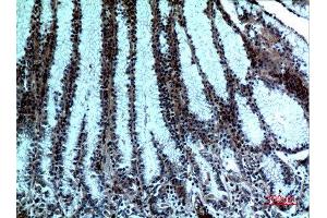 Immunohistochemistry (IHC) analysis of paraffin-embedded Human Stomach, antibody was diluted at 1:100.