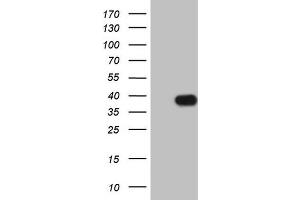 Western Blotting (WB) image for anti-Insulin-Like Growth Factor Binding Protein 1 (IGFBPI) (AA 26-259) antibody (ABIN2676854) (IGFBPI anticorps  (AA 26-259))