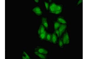 Immunofluorescent analysis of Hela cells using ABIN7151479 at dilution of 1:100 and Alexa Fluor 488-congugated AffiniPure Goat Anti-Rabbit IgG(H+L)