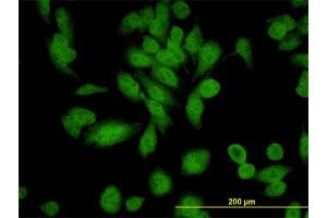 Immunofluorescence of monoclonal antibody to XAB1 on HeLa cell.