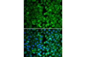 Immunofluorescence analysis of MCF-7 cells using RUNX3 antibody (ABIN6130682, ABIN6147314, ABIN6147315 and ABIN6223139).
