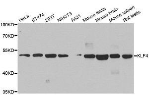 Western blot analysis of extracts of various cell lines, using KLF4 antibody. (KLF4 anticorps  (AA 180-479))