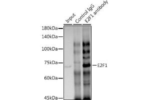 Immunoprecipitation analysis of 300 μg extracts of HT-29 cells using 3 μg E2F1 antibody (ABIN7266873).