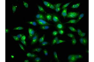 Immunofluorescence staining of Hela cells with ABIN7134517 at 1:150, counter-stained with DAPI. (Lactoferrin anticorps)