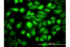Immunofluorescence of monoclonal antibody to DNAJB6 on HeLa cell.