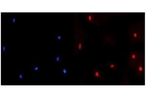 IF analysis of NUP214 using anti-NUP214 antibody (ABIN7601473).