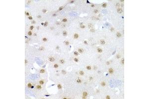 Immunohistochemistry of paraffin-embedded mouse brain using CDC27 antibody at dilution of 1:200 (40x lens). (CDC27 anticorps)