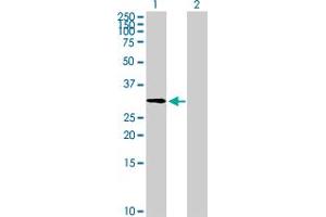 Western Blot analysis of ZNF511 expression in transfected 293T cell line by ZNF511 MaxPab polyclonal antibody. (ZNF511 anticorps  (AA 1-252))