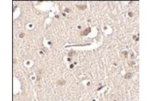 Immunohistochemistry of Slitrk2 in human brain tissue with this product at 2.