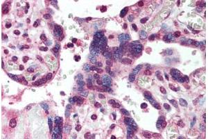 Human Placenta (formalin-fixed, paraffin-embedded) stained with SMAD2 antibody ABIN293877 at 5 ug/ml followed by biotinylated goat anti-rabbit IgG secondary antibody ABIN481713, alkaline phosphatase-streptavidin and chromogen. (SMAD2 anticorps  (AA 234-249))