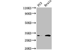 Western Blot Positive WB detected in: PC-3 whole cell lysate, Mouse brain tissue All lanes: HOXD8 antibody at 4. (HOXD8 anticorps  (AA 59-108))