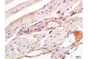 Formalin-fixed and paraffin embedded mouse heart labeled with Rabbit Anti Aggrecanase-2/ADAMTS5 Polyclonal Antibody, Unconjugated (ABIN701005) at 1:200 followed by conjugation to the secondary antibody and DAB staining