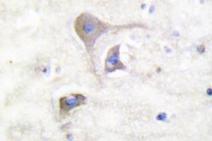 Image no. 2 for anti-Synuclein, beta (SNCB) antibody (ABIN271836) (beta Synuclein anticorps)