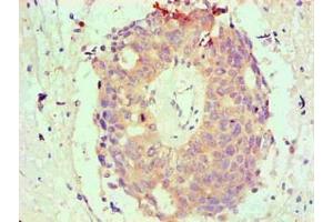 Immunohistochemical of paraffin-embedded Human endometrium tissue using ABIN7145293 at dilution of 1:200