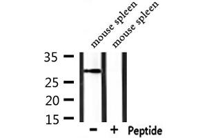 Western blot analysis of extracts from mouse spleen, using POMC Antibody.