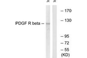 Western blot analysis of extracts from Jurkat cells, treated with TNF-a 20ng/ml 5', using PDGFR beta (Ab-740) Antibody. (PDGFRB anticorps  (AA 711-760))