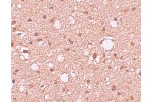 Immunohistochemical staining of human brain cells with APBA2 polyclonal antibody  at 10 ug/mL. (APBA2 anticorps  (Internal Region))