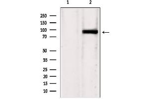 Western blot analysis of extracts from HepG2, using IFT88 antibody. (IFT88 anticorps  (C-Term))