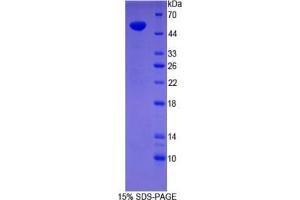 SDS-PAGE analysis of Human Synaptopodin Protein. (SYNPO Protéine)