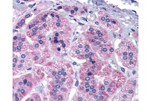 Anti-GRM7 / MGLUR7 antibody IHC of human adrenal.