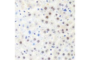 Immunohistochemistry of paraffin-embedded rat liver using POLR2B antibody. (POLR2B anticorps  (AA 1-260))