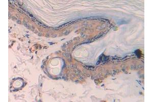 Used in DAB staining on fromalin fixed paraffin- embedded skeletal muscle tissue (CCL4 anticorps  (AA 24-92))