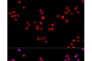 Immunofluorescence analysis of HeLa cells using ESRRA Polyclonal Antibody at dilution of 1:100. (ESRRA anticorps)